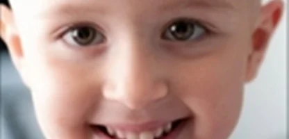 سرطان، مغلوب لبخند 5600 کودک